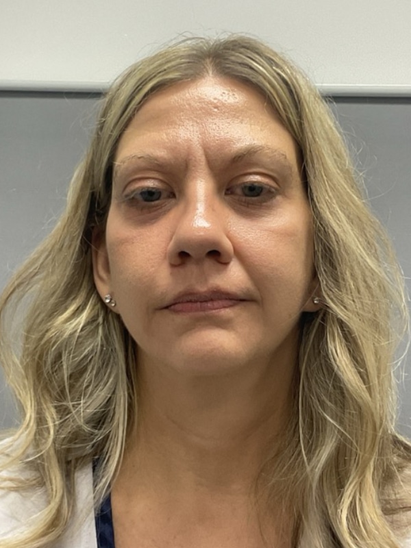 Chin Augmentation Before & After Image