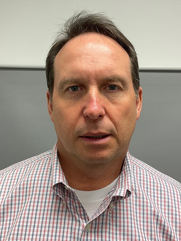 Blepharoplasty Before & After Image