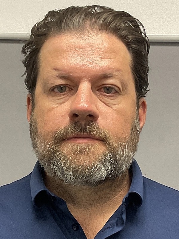 Blepharoplasty Before & After Image