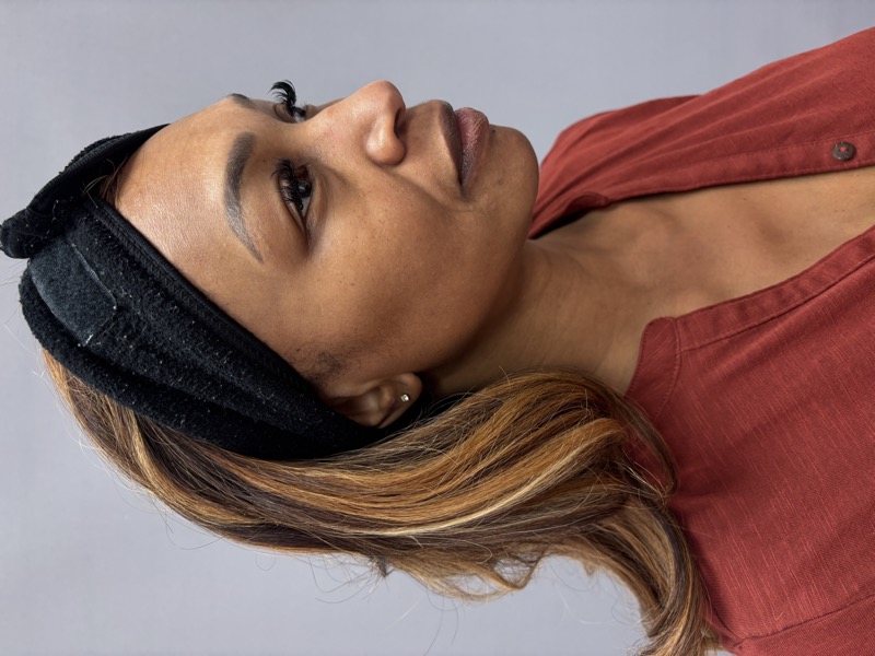 Cheek Filler Before & After Image