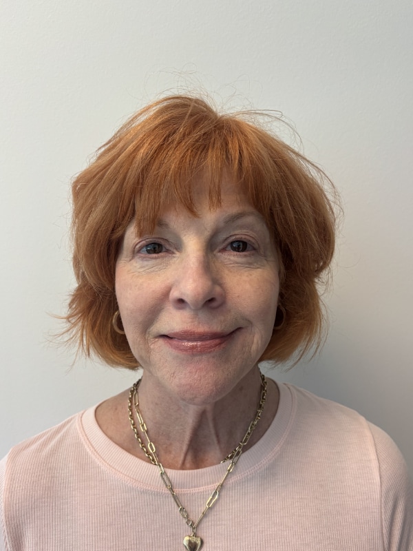 Facial Balancing Before & After Image
